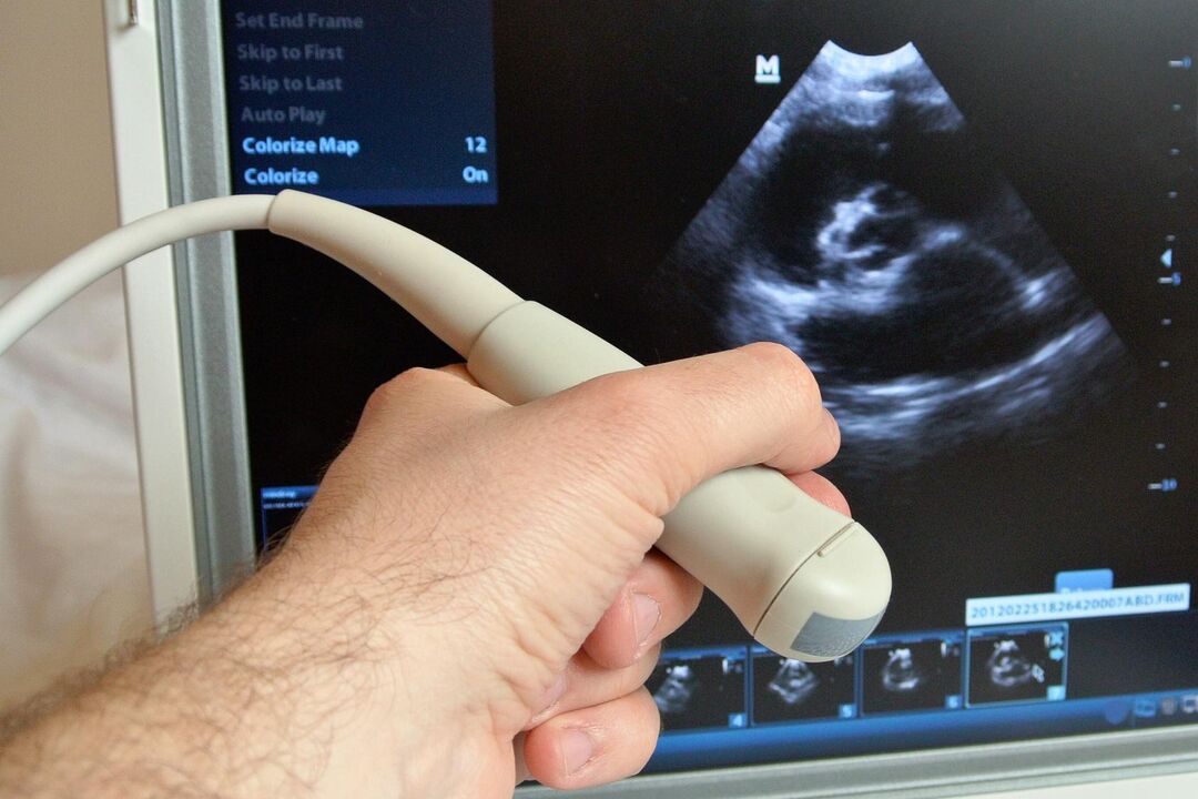 O ultrassom ajudará a diagnosticar prostatite congestiva em um homem